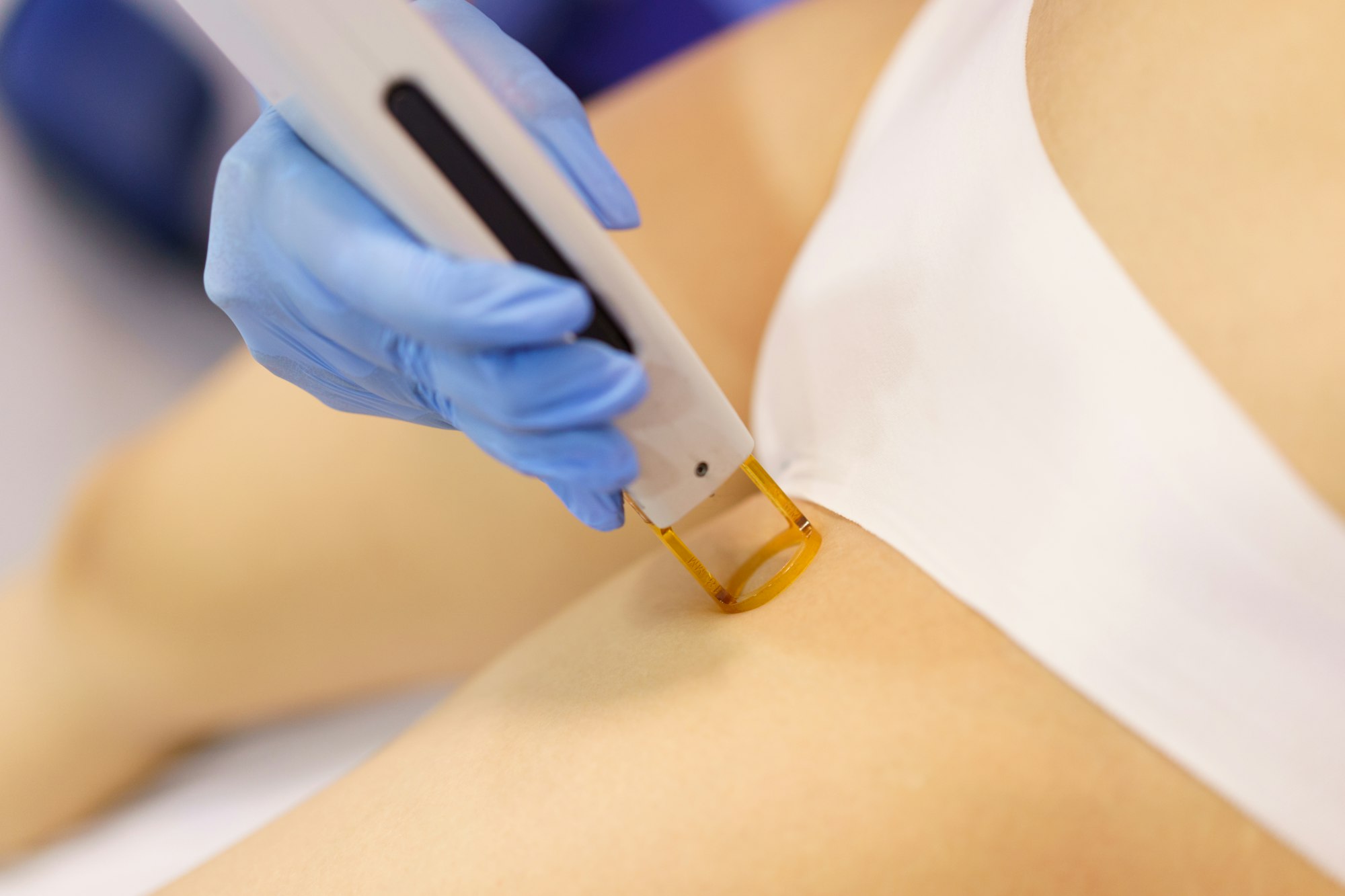 Woman receiving groins laser hair removal at a beauty center